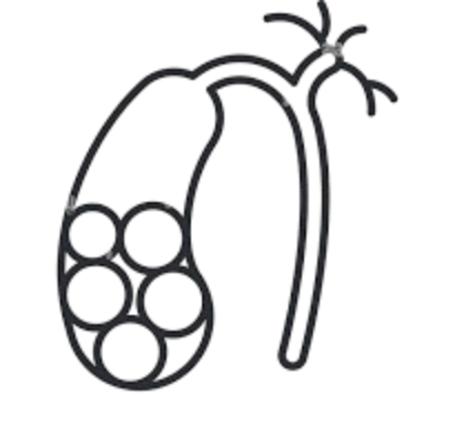 GallStone